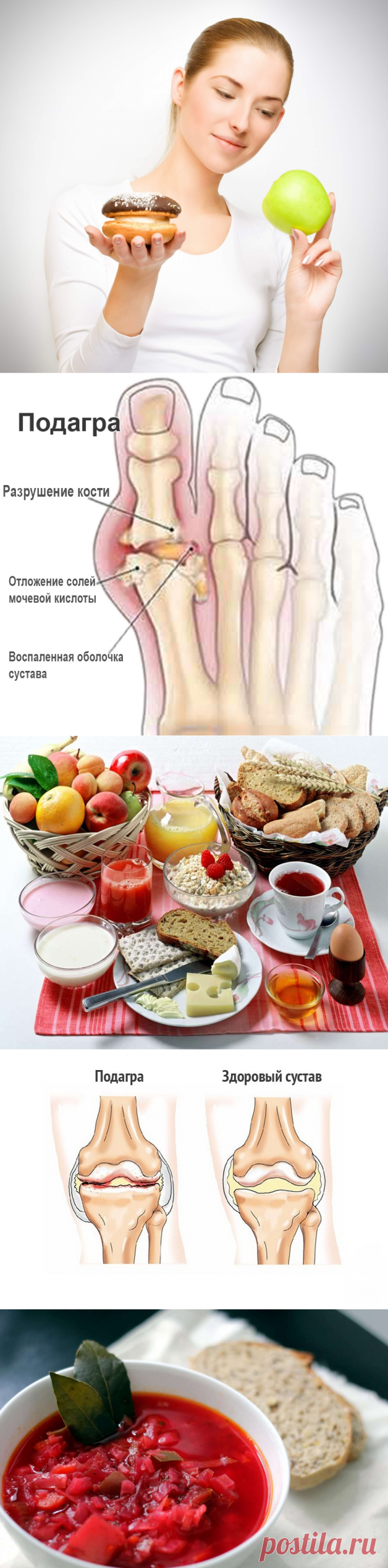 Подагра питание. Диетотерапия подагры. Подарга лечебное питание. Блюда при подагре.