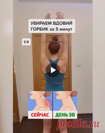 Убираем вдовий горбик за 5 минут