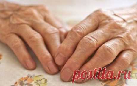 Артрит пальцев рук: народные средства лечения - Домашняя медицина