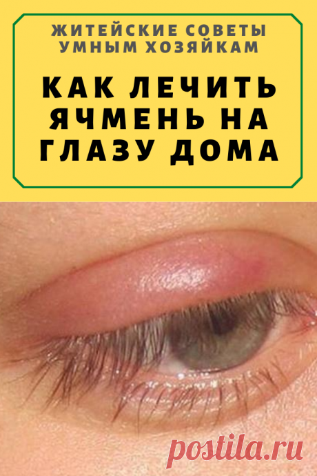 Как лечить ячмень на глазу дома народными средствами и лекарственными препаратами | Житейские Советы