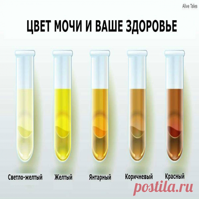 Сделай нормальный цвет. Прозрачный цвет мочи. Моча почти бесцветная. Желтая прозрачная моча. Моча цвета воды.