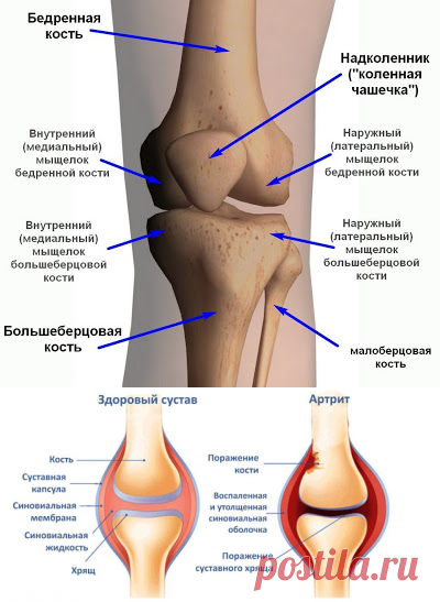 Где находится надколенник у человека фото