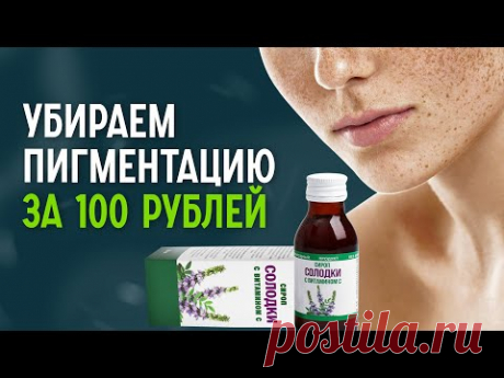 Как избавиться от пигментных пятен в домашних условиях