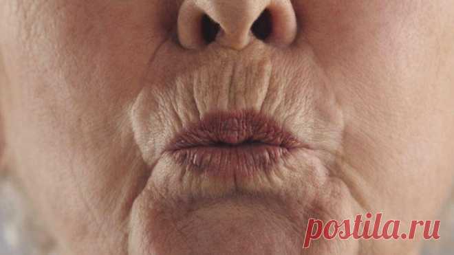 Как разгладить морщины над верхней губой, чтобы рот не выглядел, как завязанный кисет .