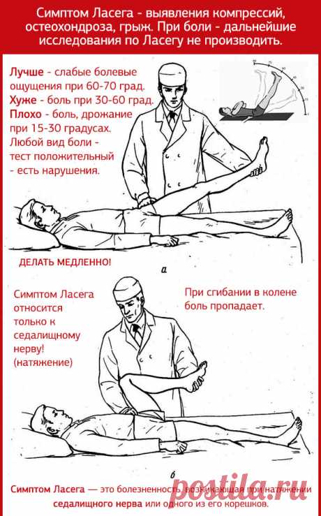 Как лечить остеохондроз поясничного отдела 2 стадии, что делать при острой боли, гимнастика, медикаменты, массаж