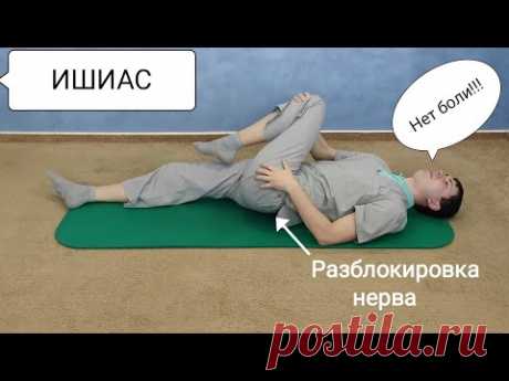 Защемление седалищьного нерва - Синдром грушевидной мышцы, ишиас, ишиалгия