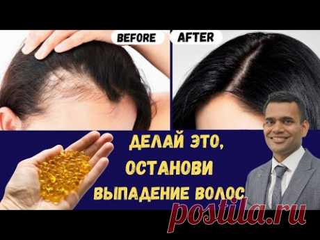 Предотвратите Выпадение Волос И Отрастите Волосы | Доктор Вивек