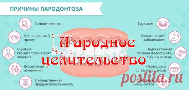 ДОМАШНИЕ СРЕДСТВА ДЛЯ ПРОФИЛАКТИКИ И ЛЕЧЕНИЯ ПАРОДОНТОЗА

Пародонтоз – патологический процесс, при котором происходит рассасывание тканей вокруг зубов. По этой причине зубы обнажаются, постепенно теряя свою фиксацию. Заболевание длительное время проходит бессимптомно и безболезненно.

Первым сигналом прогрессирующего заболевания служит повышенная реакция на действие термических и химических раздражителей. Постепенно появляется кровоточивость десен. В конечном итоге заболев...