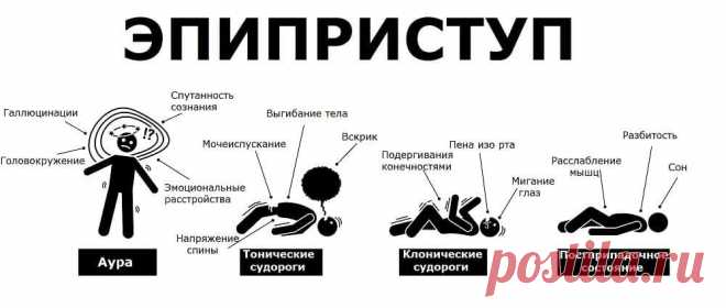 Эпилепсия. Что такое приступ эпилепсии – его причины, признаки и симп ...