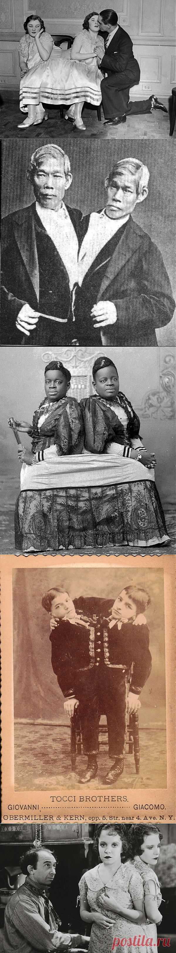 10 любопытных историй о знаменитых сиамских близнецах | Любители истории