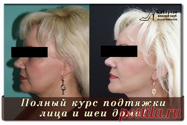 Полный курс подтяжки лица и шеи из 12 - 15 процедур в домашних условиях