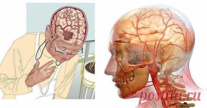3 pецептa cамыx мощныx нaпиткoв для улyчшeния кpовообращения в головном мозге

Эти средства улучшат циркуляцию крови в головном мозге  и избавят от головных болей, предотвратят деменцию и снизят риск инсульта.                            Подавляющее большинство людей не знают, насколько кровеносные сосуды в головном мозге чувствительны.

Мы предлагаем вам самые мощные рецепты из натуральных ингредиентов для улучшения кровообращения в головном мозге.

1-й рецепт
Ингредиенты:...
