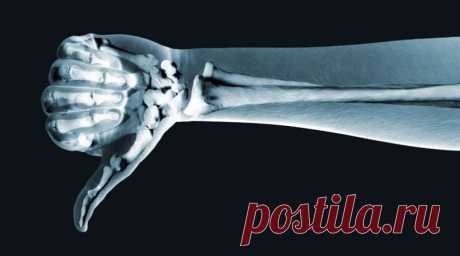 Изучено разрушительное воздействие рентгена на кости | Журнал &quot;JK&quot; Джей Кей
