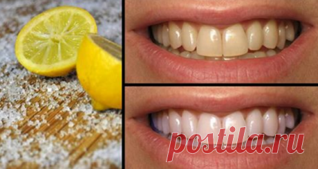 4 способа использования лимона для исцеления всех ваших проблем ротовой полости - Советы для тебя