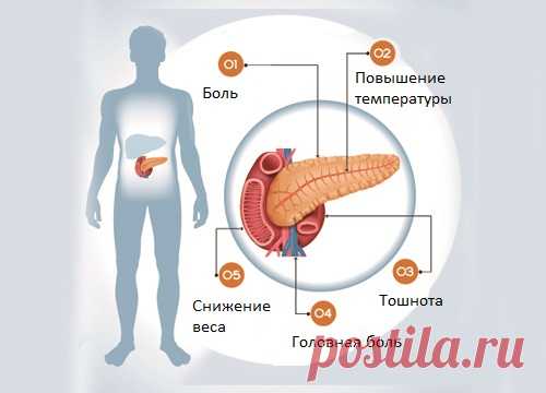 6 симптомов нарушения работы поджелудочной железы - Шаг к Здоровью