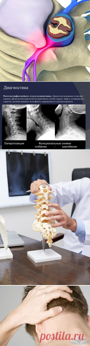 Головная боль в затылке: основные причины и методы лечения у женщин и мужчин