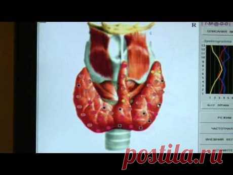 Заболевания щитовидной железы (Лекция 10/1) - Петрова И.Ф.