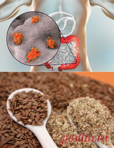 ДОМАШНЕЕ СРЕДСТВО, КОТОРОЕ ВЫГОНИТ ИЗ ОРГАНИЗМА ВСЕХ ПАРАЗИТОВ И ИЗБАВИТ ОТ КУЧИ БОЛЕЗНЕЙ! РЕКОМЕНДУЮ! — Journal women❜s