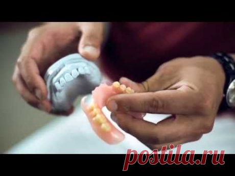 Преимущества базальной имплантации зубов перед съемным протезированием