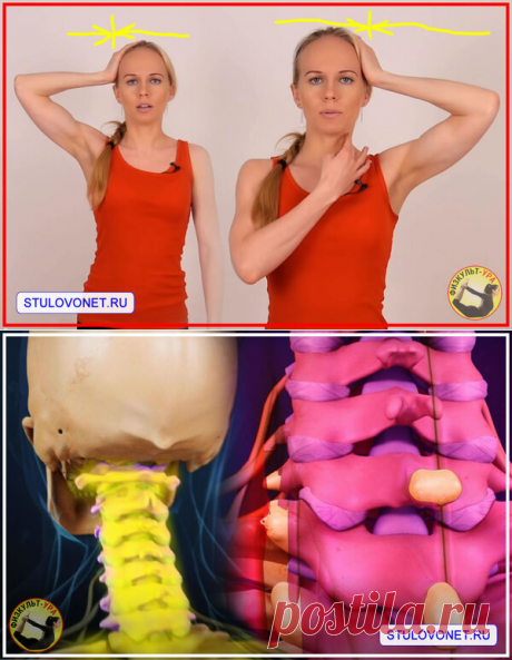 ⚡️Синдром позвоночной артерии и Обострение шейного остеохондроза. 👩‍Только изометрические упражнения | Физкульт-Ура | Яндекс Дзен