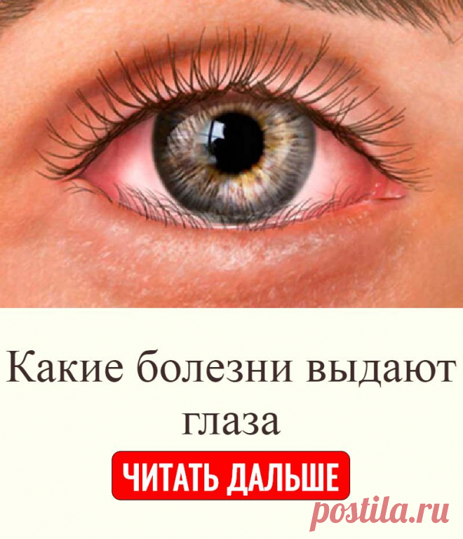 Какие болезни выдают глаза | Полезные советы | Постила