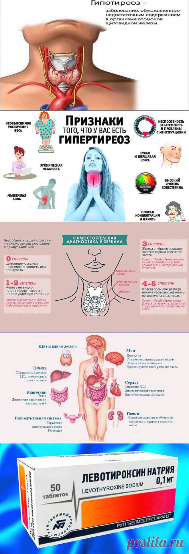 Недостаток гормона щитовидной железы вызывает. Гипофункция щитовидной железы. Гипотиреоз и хроническая усталость. Гипотиреоз печени что это и как лечить. Свиной гормон щитовидной железы купить.