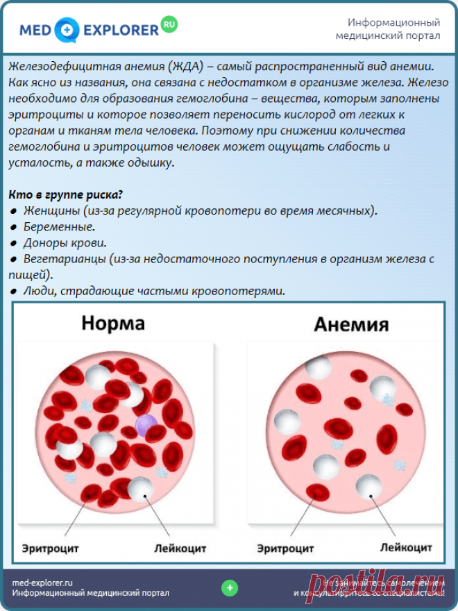 Анемия крови что это. Картина крови при железодефицитной анемии. Железодефицитная гипохромная анемия исследование. Показатели крови анемия железодефицитная норма. Картина периферической крови при железодефицитной анемии.