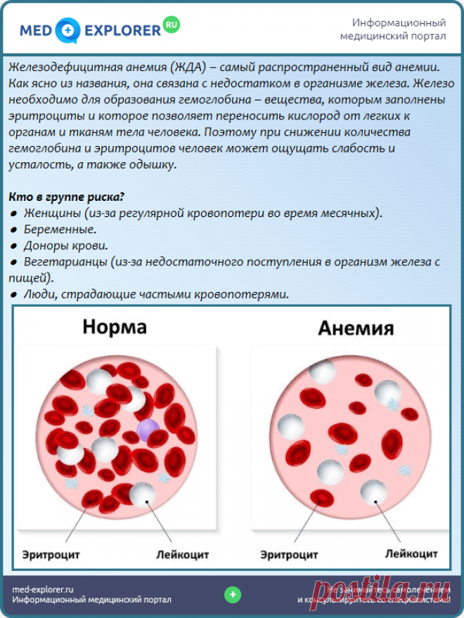 Анемия и вес