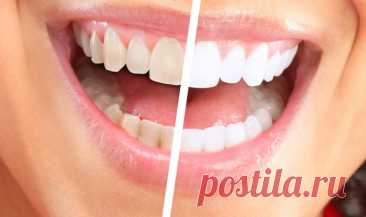 Самодельные методы отбеливания зубов: эффективны ли они?
