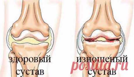 Запись на стене Отличный рецепт от боли в суставахПростейший народный рецепт для лечения суставов.(не смотрите, что простой, очень много отзывов об эффективности этого рецепта&#33;)Наверняка многие не по наслышке знают, что такое боли в суставах. Какой, мягко скажем, дискомфорт доставляют они чел..