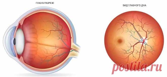 Глаза — зеркало здоровья. Какие сердечно-сосудистые заболевания можно выявить при осмотре офтальмологом? | ИМА ВИЖН | Дзен