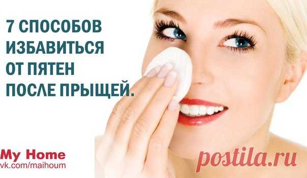 КАК ИЗБАВИТЬСЯ ОТ ПЯТЕН ПОСЛЕ ПРЫЩЕЙ | красота | Постила