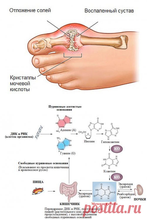 Как избавиться от мочевой кислоты в организме. Выведение мочевой кислоты. Экскреция мочевой кислоты. Выведению солей мочевой кислоты. Выведение мочевой кислоты из организма.