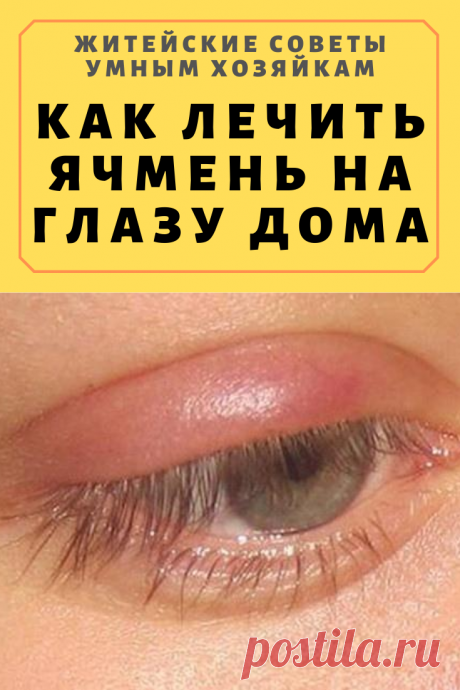 Как лечить ячмень на глазу дома народными средствами и лекарственными препаратами | Житейские Советы