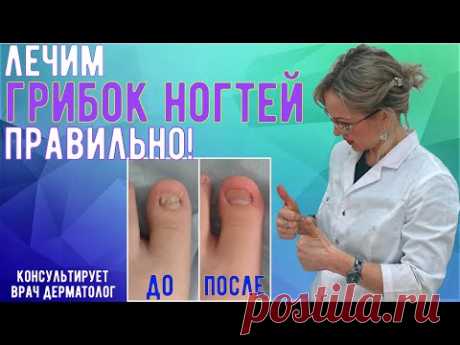 Правильное лечение грибка ногтей, онихомикоза