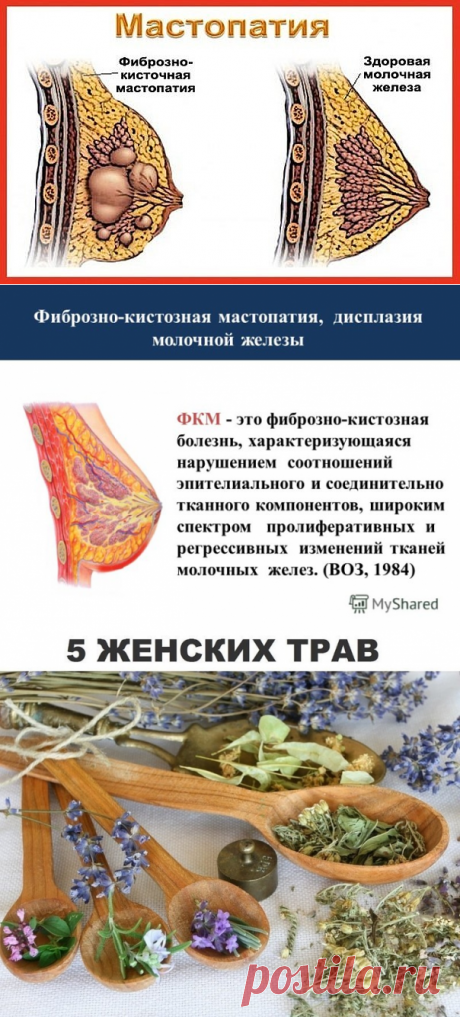 Мастопатия боится валерианы и зверобоя