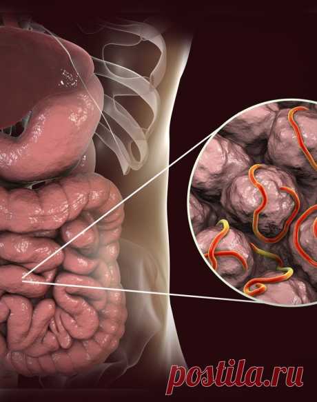 Способы очистить организм от паразитов Паразиты — это организмы, которые обитают на хозяине / внутри него и получают пищу за его счет. Негативные последствия паразитоза — это сбои пищеварения (диарея, рвота, боли в желудке, потеря аппетита, вялость). Стратегия исцеления включает диету по очищению от паразитов (отказ от сладкого, от переработанных продуктов, употребление антиоксидантных продуктов) и применение целебных трав. ...