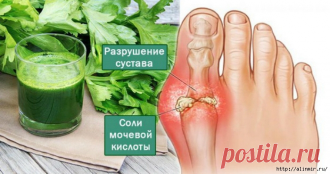 Как вывести кристаллы мочевой кислоты из суставов