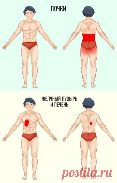 ПРИЧИНА БОЛИ И МЕСТО ЕЁ ЛОКАЛИЗАЦИИ