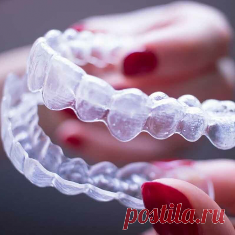 2023-Элайнеры: invisalign, star smile, flexiligner, 3D smile - Палома Бланка (Paloma Blanca) - Стоматологическая клиника