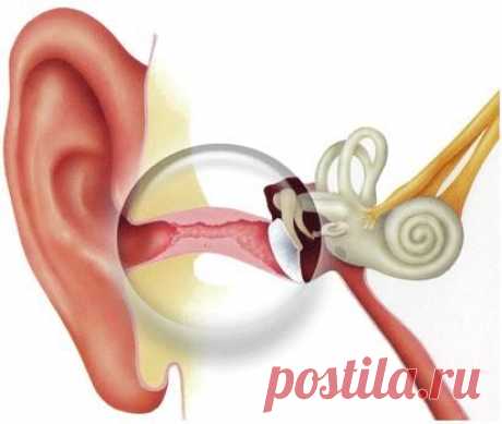 Народные рецепты лечения отита (воспаление среднего уха)
