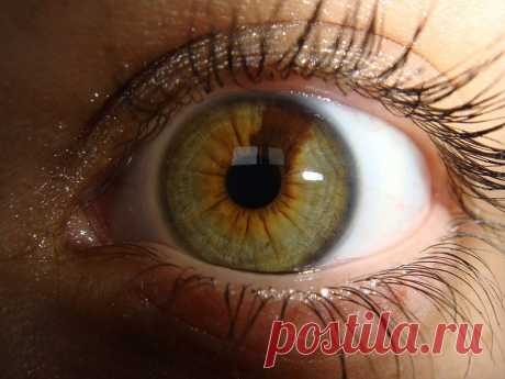 люди с янтарным цветом глаз считаются- от светло коричневого, до желтого оттенка