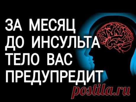 Перед инсультом ваше тело предупредит вас