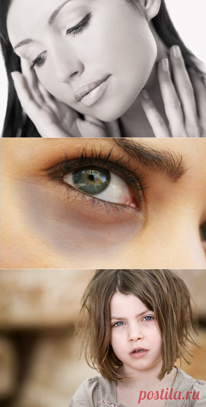 бледное лицо и синяки