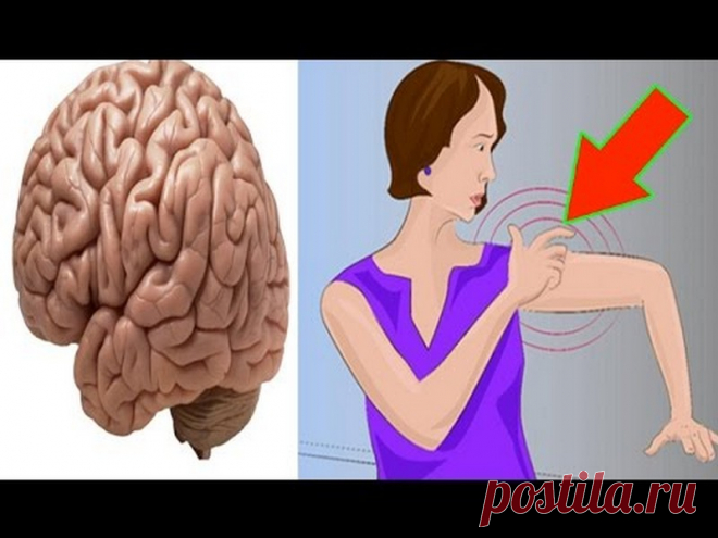 Предупреждающие признаки инсульта, о которых вы должны знать - Журнал ...