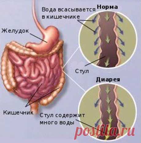 Натуральные средства при диарее