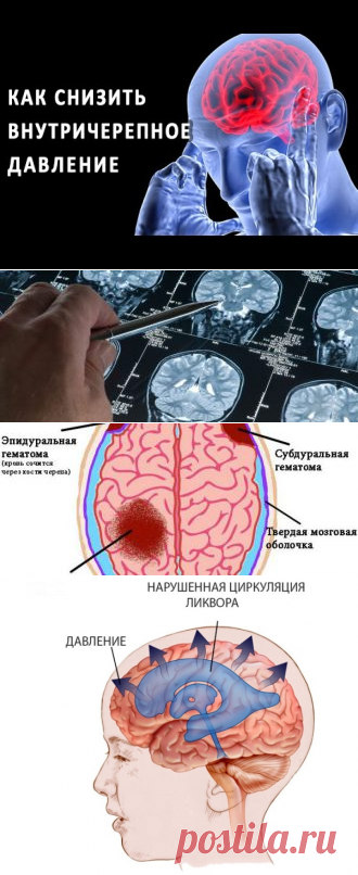 Как измерить внутричерепное давление в домашних условиях здоровье ГОЛОВА, ШЕЯ По