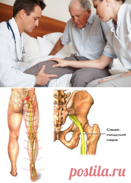 Что делать, если болит колено при сгибании? Причины и лечение | ПолонСил.ру - социальная сеть здоровья