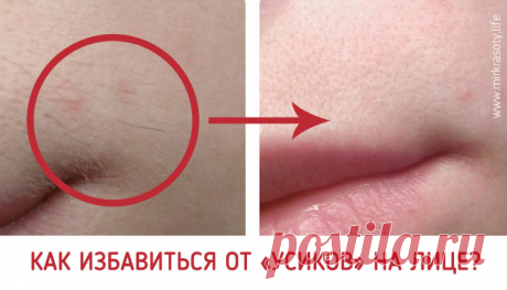 Как избавиться от «усиков» на лице? Растительность над верхней губой у женщин — деликатная и довольно неприятная проблема. Как правило, причиной появления таких «усиков» является повышенный уровень тестостерона в организме (что, кстати, не всегда требует лечения).

Первое, что приходит в голову, это использовать воск для эпиляции (или не дай бог, сбрить). Но такая процедура сильно раздражает кожу, оставляет покраснения. Мы предлагаем способ намного проще и безболезненней, ...