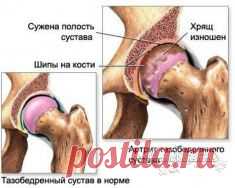 НАСТУПИТ СРОК, УЙДЁТ АРТРИТ И БОЛЬШЕ ВАС НЕ ПОСЕТИТ